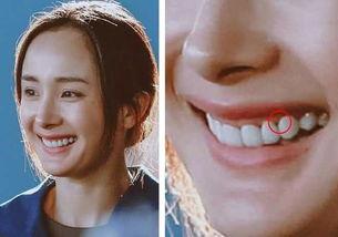 明星做假牙,从幕后到台前，假牙如何助力星光熠熠
